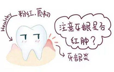 牙龈炎是什么样？看牙龈炎图片及治疗方法了解它
